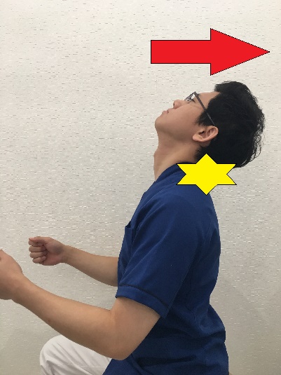 むち打ち＿首が後ろに反る